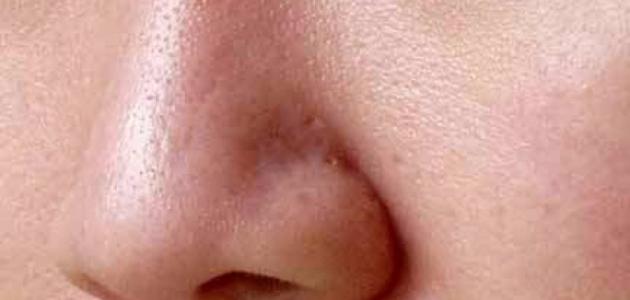 طرق طبيعية لعلاج وغلق مسامات الوجه والأنف