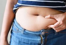 أسباب والعلاج تكدس الدهون في منطقة البطن