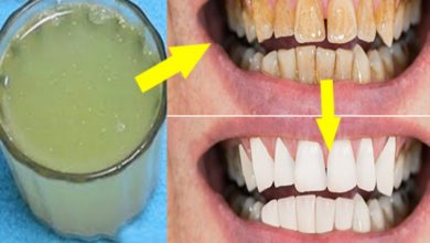 خلطات طبيعية لتبييض الأسنان