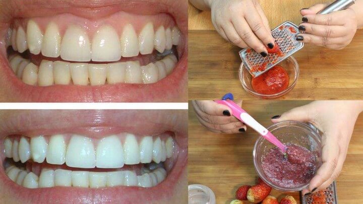 وصفة من مواد طبيعية لتبييض الأسنان