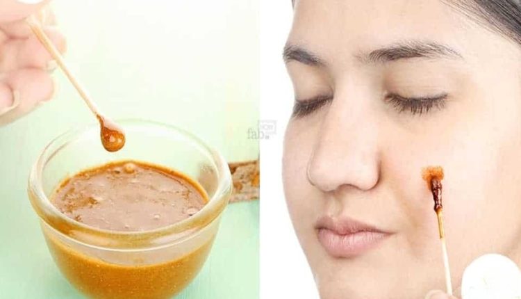 أقوى قناع مجرب ومضمون في علاج حب الشباب والقضاء عليه نهائيا