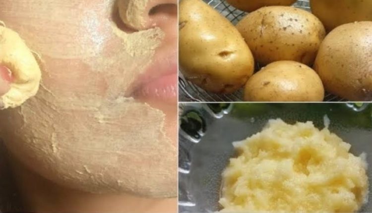 خلطة البطاطس الجبارة لبشرة ناصعة البياض وخالية من البقع
