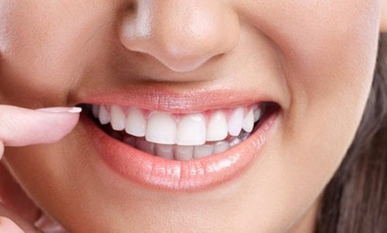 علاج تآكل الأسنان بالأعشاب