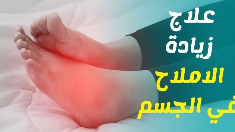 علاج زيادة الأملاح بالأعشاب ومن الصيدلية
