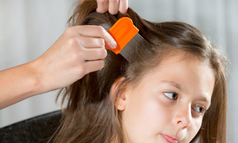 طرق التخلص من القمل