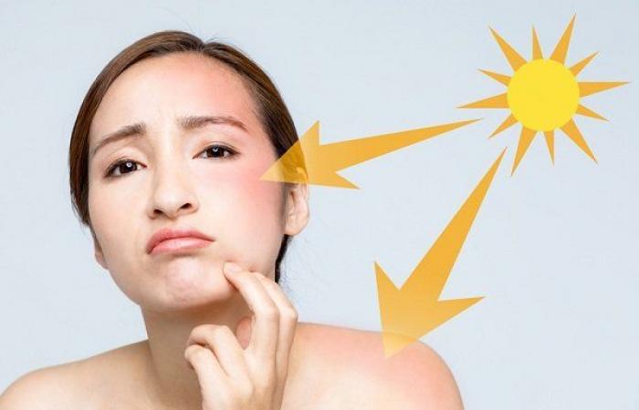 كيف يمكن الوقاية من أضرار الشمس