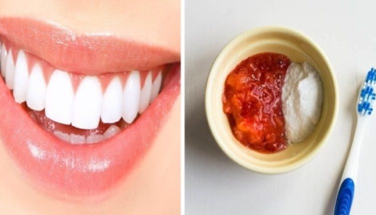 الحصول على أسنان ناصعة البياض بوقت قصير بمزج هذين المكونين