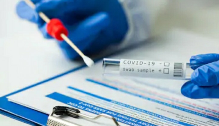دواعي إجراء وشروط تحليل PCR