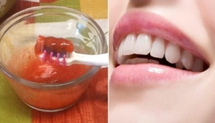 الخلطة الطبيعية الرائعة والمثالية في تبييض الأسنان بسهولة