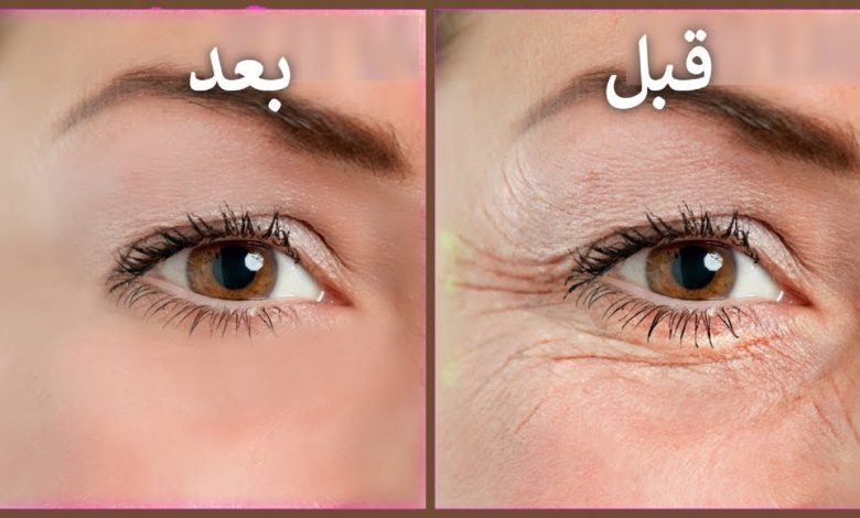 تخلصي من الهالات السوداء وتجاعيد العين بهذا السيروم الطبيعي