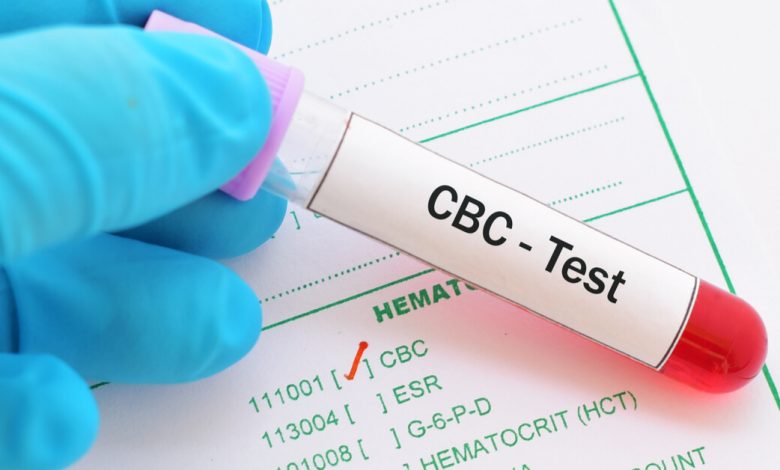 هل فحص cbc يكشف الإيدز بعد الإصابة