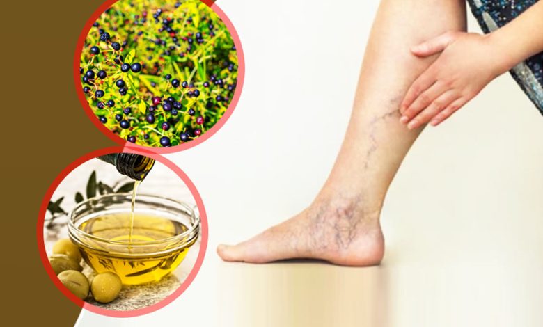 علاج جلطة الساق باستخدام الأعشاب والطرق الطبيعية