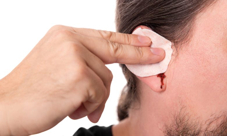 5 من أهم أسباب نزيف الأذن