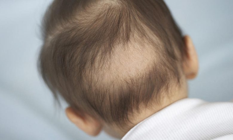 أسباب تساقط شعر الأطفال