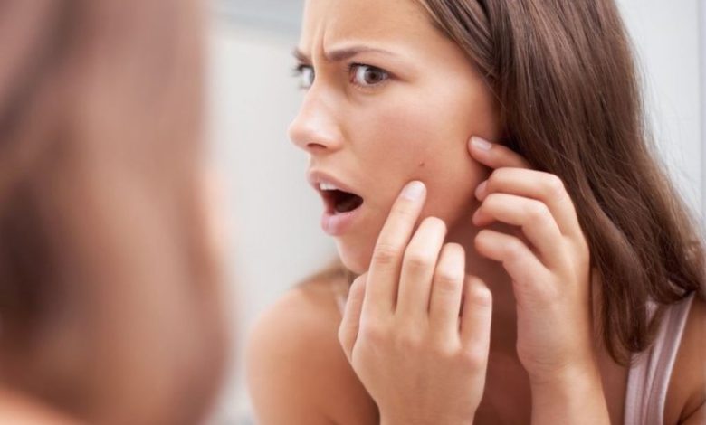 تخلصي من حبوب وجهك بسرعة بالخلطات المنزلية