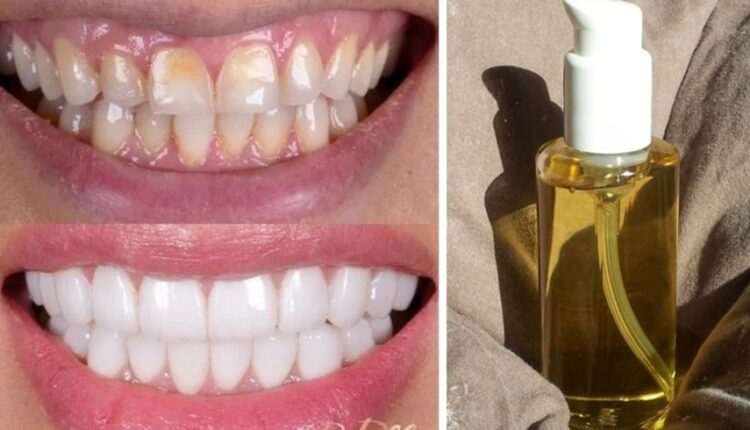 مع هذا الزيت السحري سيكون لديك أسنان بيضاء لامعة مثل اللؤلؤ