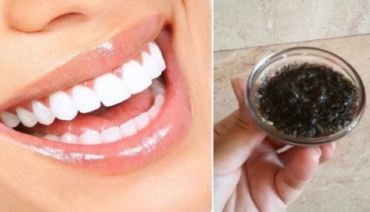 مكونات طبيعية خطيرة تعمل على تبييض الأسنان بدون طبيب