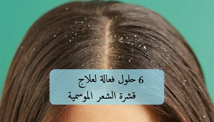 6 حلول فعالة لعلاج قشرة الشعر الموسمية